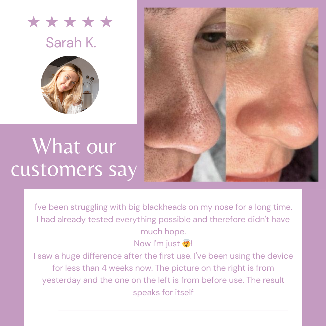 HydraGlow™ I Deep cleansing for pore-deep clean skin!