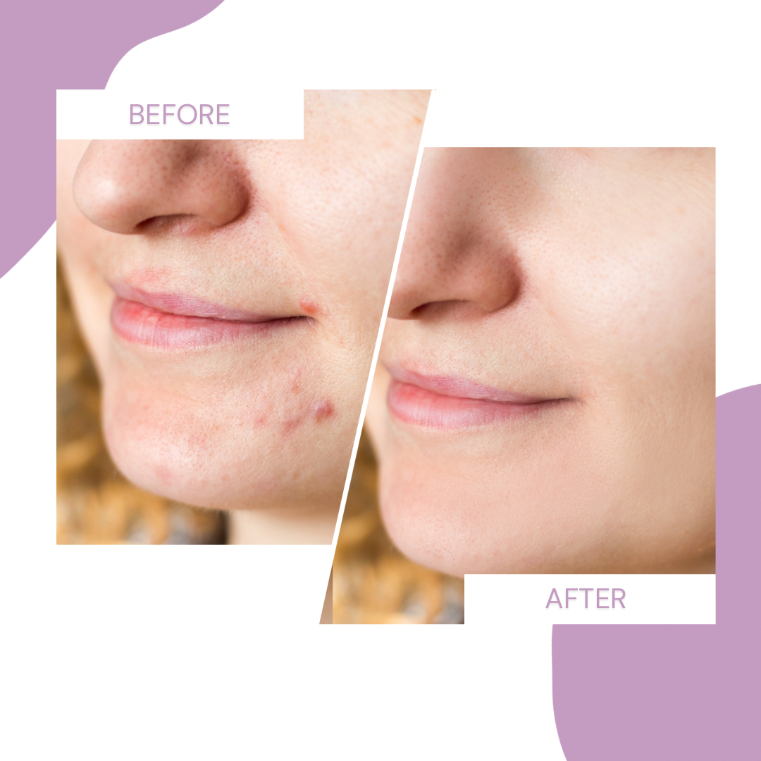 HydraGlow™ I Deep cleansing for pore-deep clean skin!