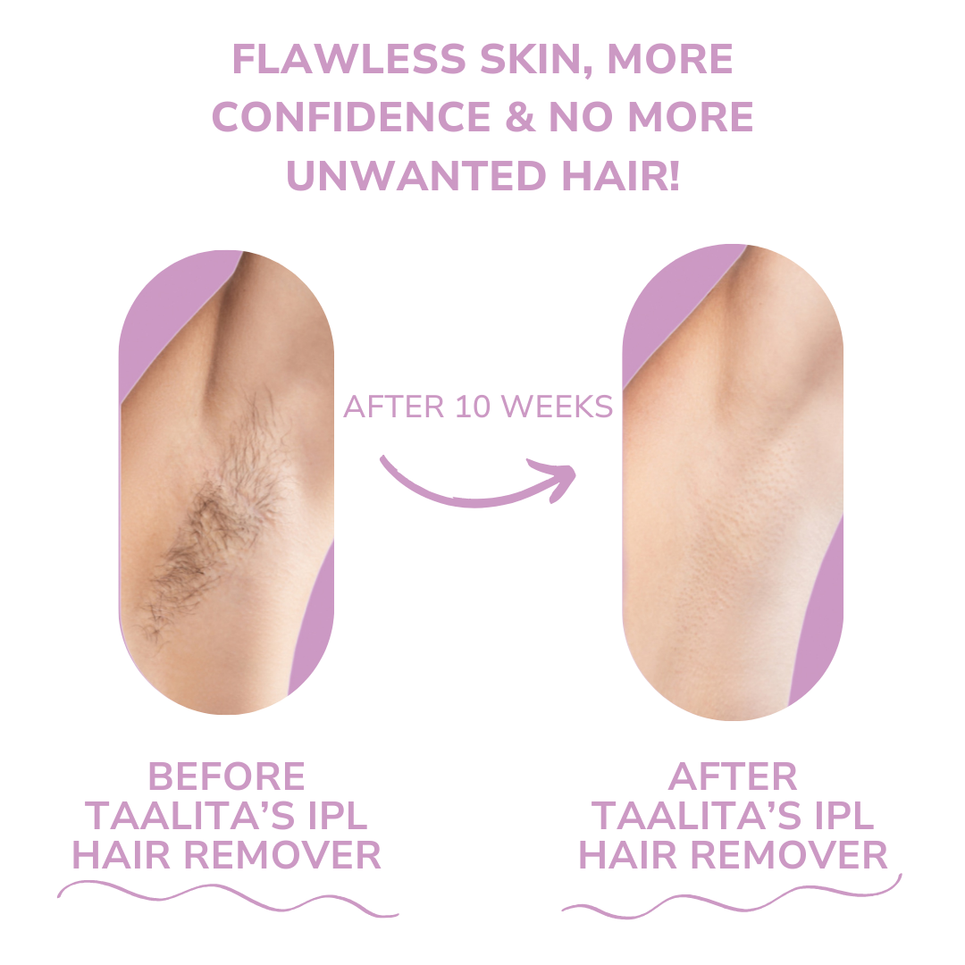 CelinCare™ LumiSilk I Effortless Luxury Hair Removal at Home