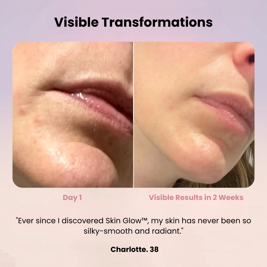 Skin Glow 2.0™ I Radiance Enhancer