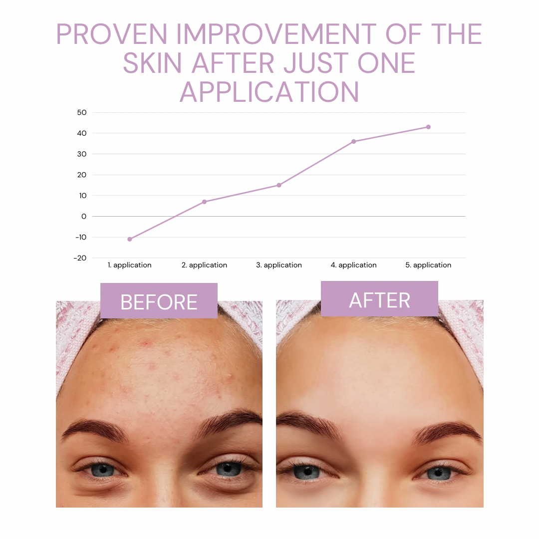 HydraGlow™ I Deep cleansing for pore-deep clean skin!