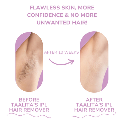 CelinCare™ LumiSilk I Effortless Luxury Hair Removal at Home