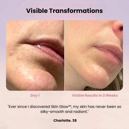 Skin Glow 2.0™ I Radiance Enhancer