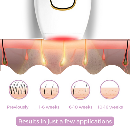 CelinCare™ LumiSilk I Effortless Luxury Hair Removal at Home